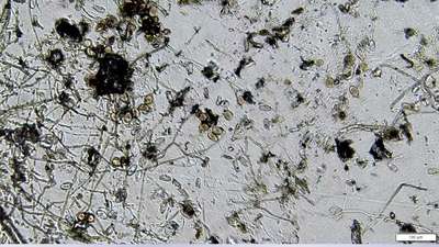 Rust spore found in sample